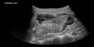 Rose ultrasound